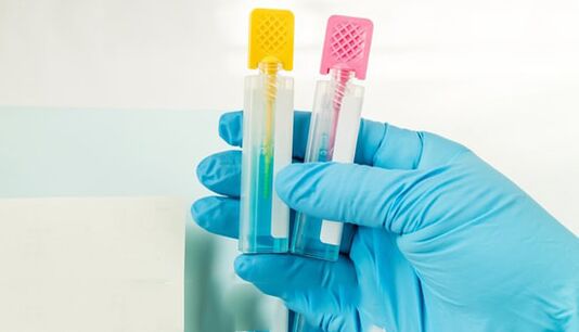 Parazītu diagnostikas metodes